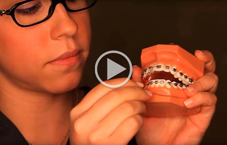 AAO Brushing and Flossing Video Sacramone Orthodontics in Newtonville, MA